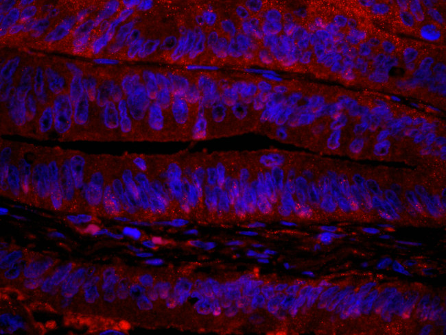 RanBP1 Antibody in Immunohistochemistry (Paraffin) (IHC (P))