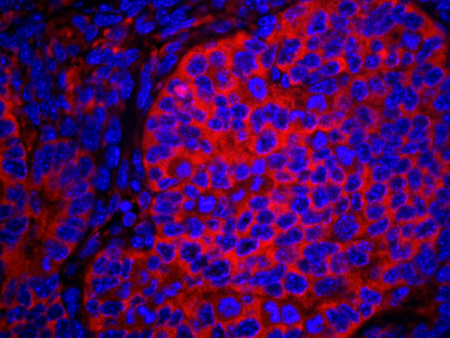 eIF2alpha/EIF2S1 Antibody in Immunohistochemistry (Paraffin) (IHC (P))