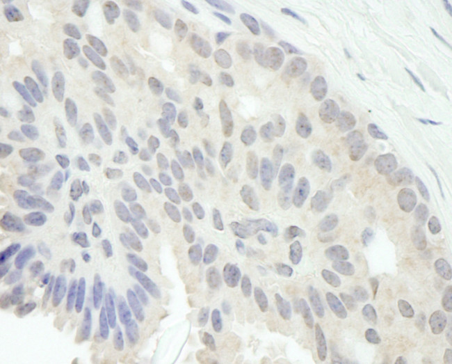 E2F1 Antibody in Immunohistochemistry (Paraffin) (IHC (P))