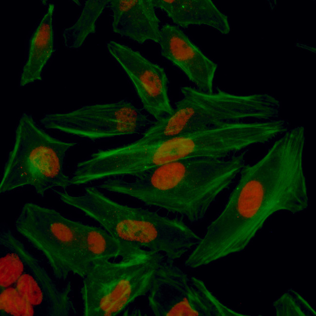 HIF1-alpha Antibody in Immunocytochemistry (ICC/IF)