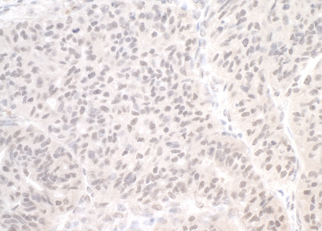 PIMT Antibody in Immunohistochemistry (Paraffin) (IHC (P))