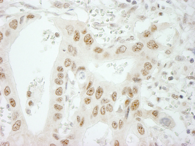 SKIV2L2 Antibody in Immunohistochemistry (Paraffin) (IHC (P))