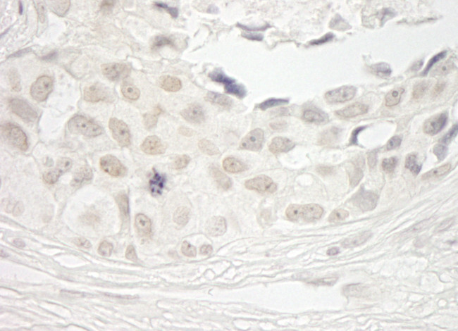 PPP1CB Antibody in Immunohistochemistry (Paraffin) (IHC (P))