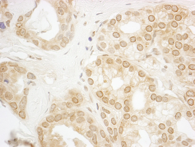 PPP3CA Antibody in Immunohistochemistry (Paraffin) (IHC (P))