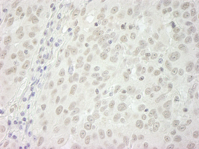 BubR1 Antibody in Immunohistochemistry (Paraffin) (IHC (P))