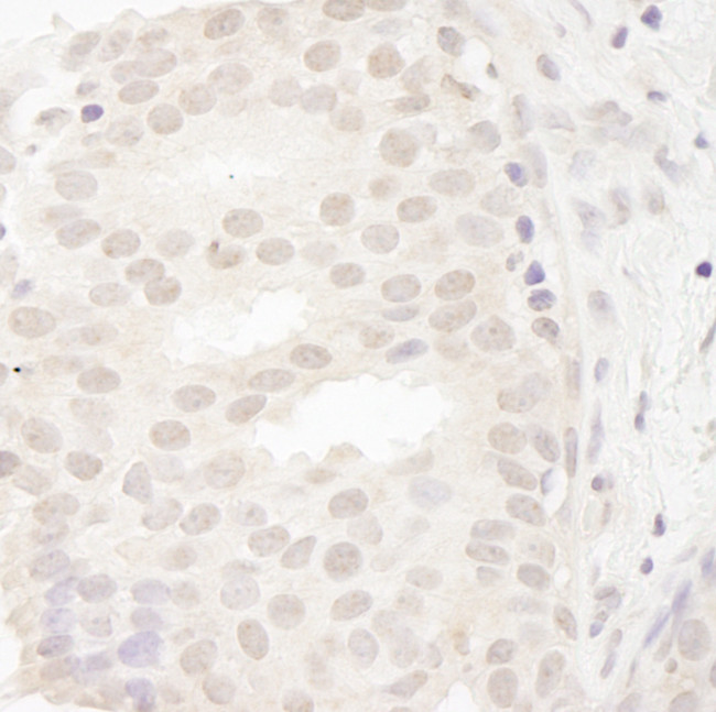 CASC5 Antibody in Immunohistochemistry (Paraffin) (IHC (P))