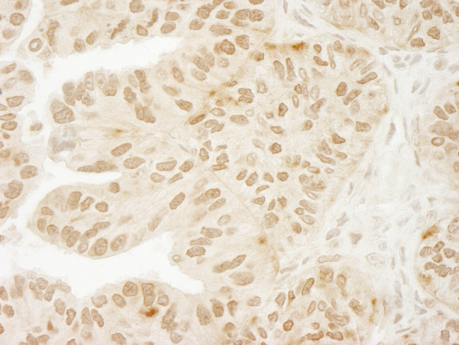 USP15 Antibody in Immunohistochemistry (Paraffin) (IHC (P))