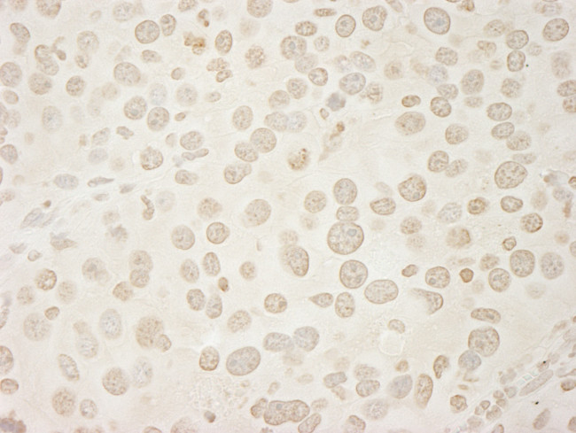 USP33 Antibody in Immunohistochemistry (Paraffin) (IHC (P))