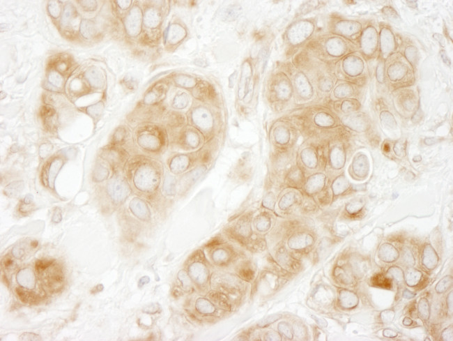 GIT1 Antibody in Immunohistochemistry (Paraffin) (IHC (P))