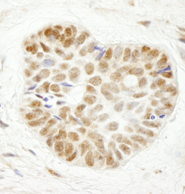 WDR79 Antibody in Immunohistochemistry (Paraffin) (IHC (P))