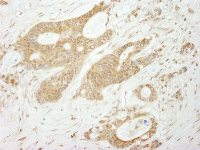 Notch1 Antibody in Immunohistochemistry (Paraffin) (IHC (P))