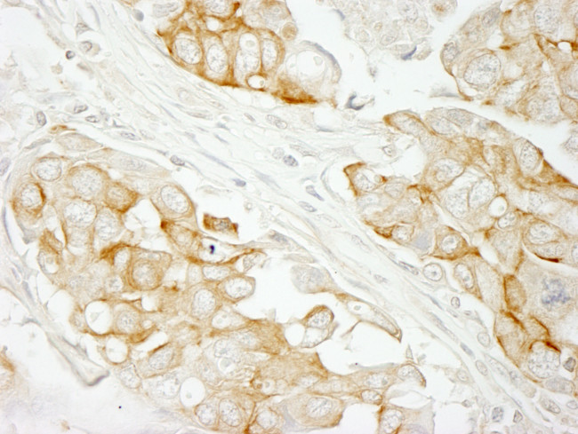 Notch2 Antibody in Immunohistochemistry (Paraffin) (IHC (P))