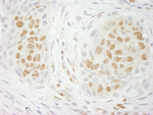 GIT2 Antibody in Immunohistochemistry (Paraffin) (IHC (P))