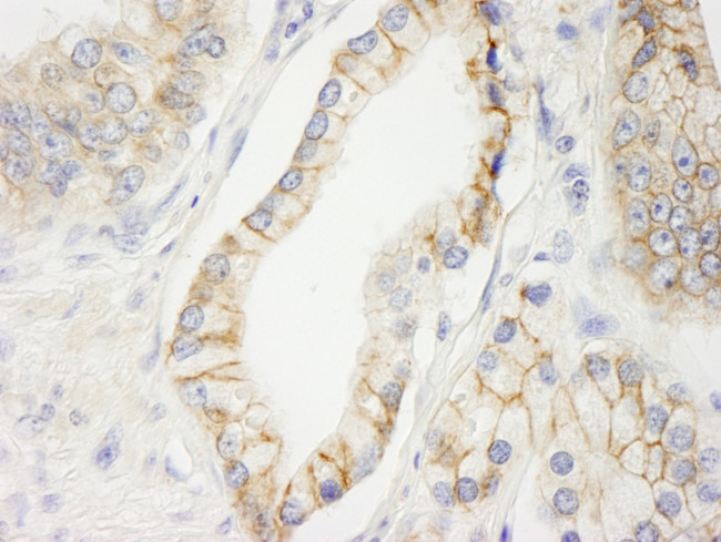 KIAA0528 Antibody in Immunohistochemistry (Paraffin) (IHC (P))