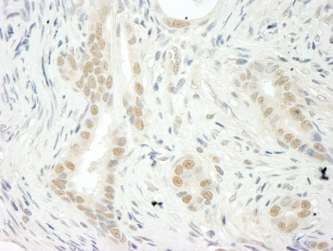 THOC5 Antibody in Immunohistochemistry (Paraffin) (IHC (P))