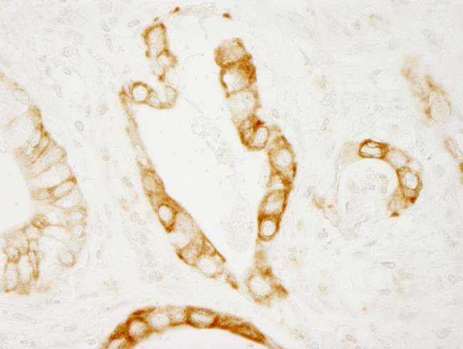 PKD2 Antibody in Immunohistochemistry (Paraffin) (IHC (P))