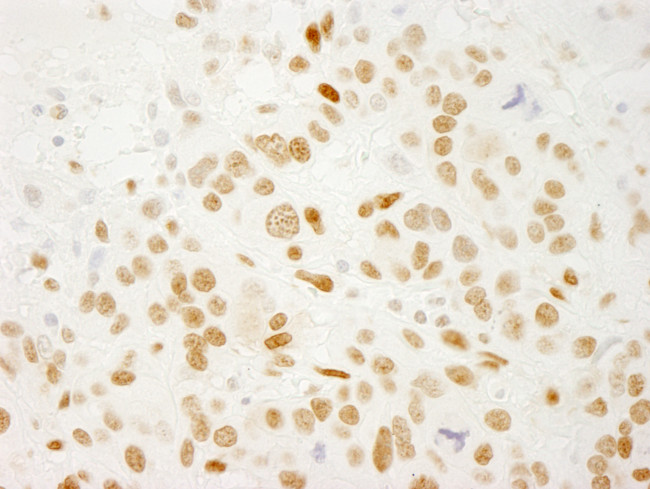 QKI Antibody in Immunohistochemistry (Paraffin) (IHC (P))