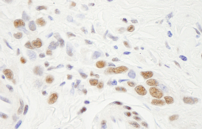 NF-YA Antibody in Immunohistochemistry (Paraffin) (IHC (P))