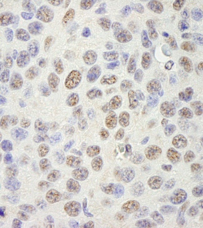 SAM68 Antibody in Immunohistochemistry (Paraffin) (IHC (P))