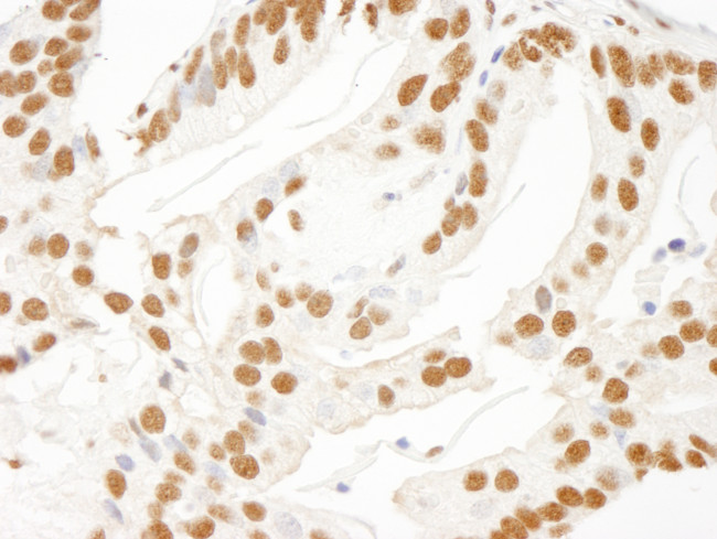 KSRP Antibody in Immunohistochemistry (Paraffin) (IHC (P))