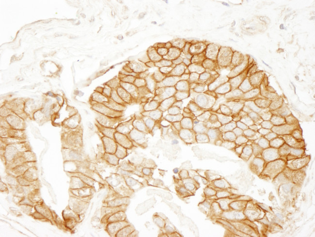 Beta-catenin Antibody in Immunohistochemistry (Paraffin) (IHC (P))