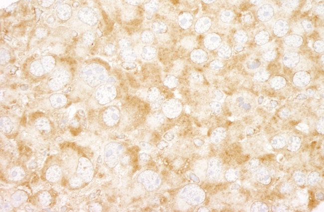 UVRAG Antibody in Immunohistochemistry (Paraffin) (IHC (P))