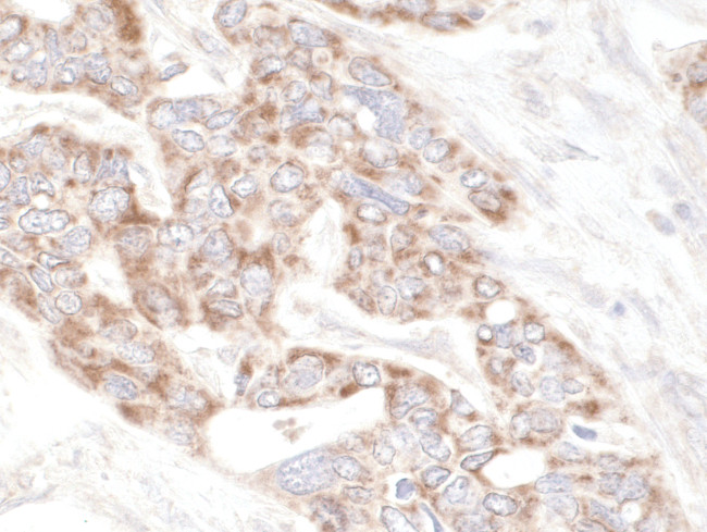 PDZ-GEF1 Antibody in Immunohistochemistry (Paraffin) (IHC (P))