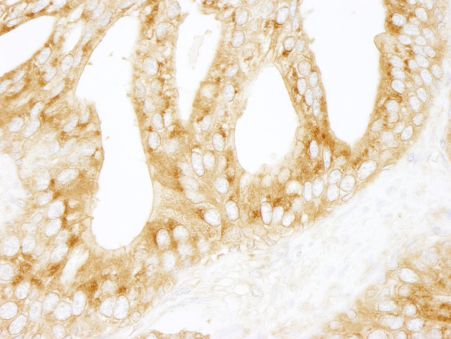 PRKAR2A/PKA-RIIalpha Antibody in Immunohistochemistry (Paraffin) (IHC (P))