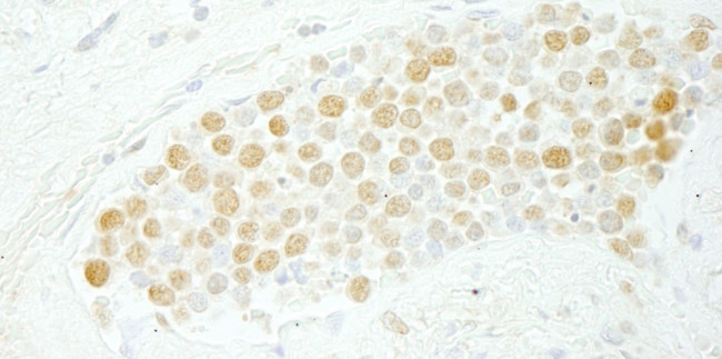 CDC5L Antibody in Immunohistochemistry (Paraffin) (IHC (P))