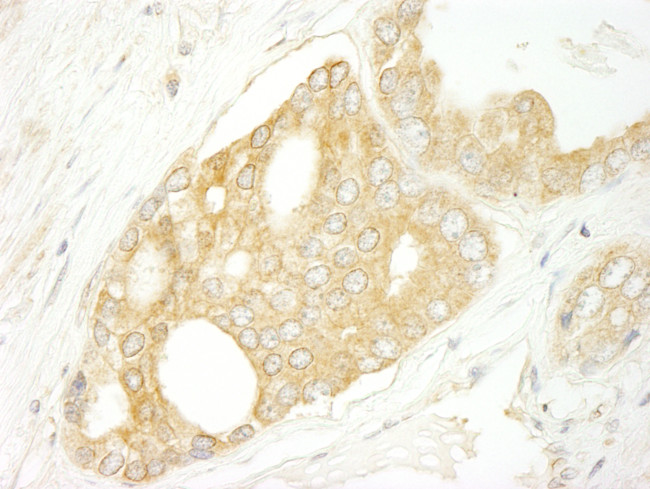 BRAF Antibody in Immunohistochemistry (Paraffin) (IHC (P))