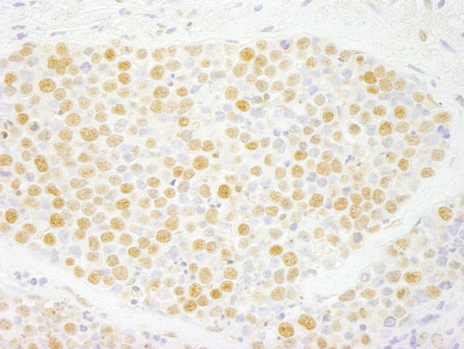 ZNF198 Antibody in Immunohistochemistry (Paraffin) (IHC (P))