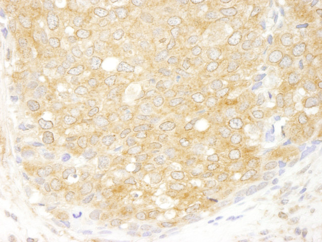 eIF2beta/EIF2S2 Antibody in Immunohistochemistry (Paraffin) (IHC (P))