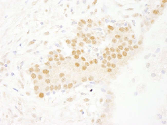 SET7 Antibody in Immunohistochemistry (Paraffin) (IHC (P))