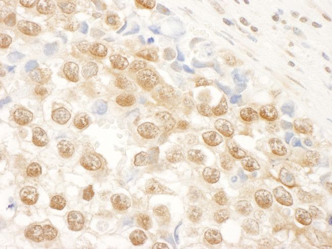 NARG1 Antibody in Immunohistochemistry (Paraffin) (IHC (P))