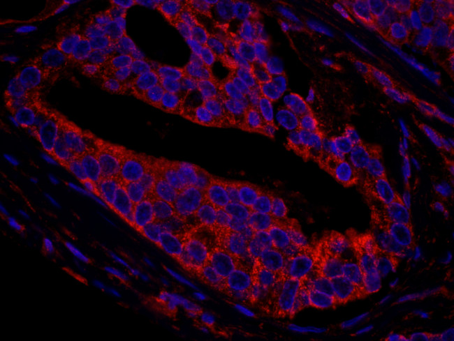 CNOT3 Antibody in Immunohistochemistry (Paraffin) (IHC (P))