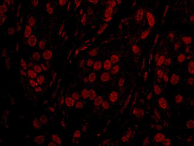 TOPORS Antibody in Immunohistochemistry (Paraffin) (IHC (P))