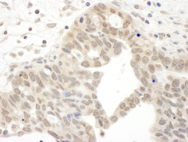 JAK2 Antibody in Immunohistochemistry (Paraffin) (IHC (P))