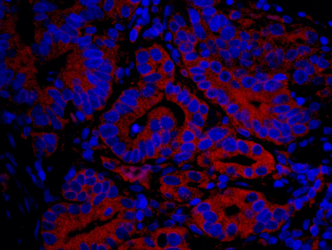 IP3R3 Antibody in Immunohistochemistry (Paraffin) (IHC (P))