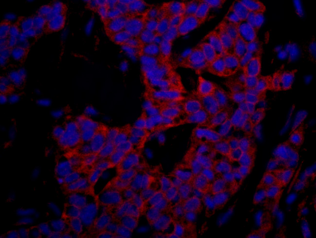 p600 Antibody in Immunohistochemistry (Paraffin) (IHC (P))