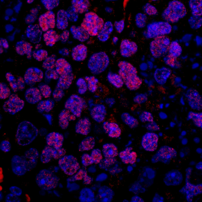 FUSIP1 Antibody in Immunohistochemistry (Paraffin) (IHC (P))