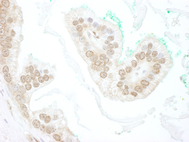 BTBD12 Antibody in Immunohistochemistry (Paraffin) (IHC (P))