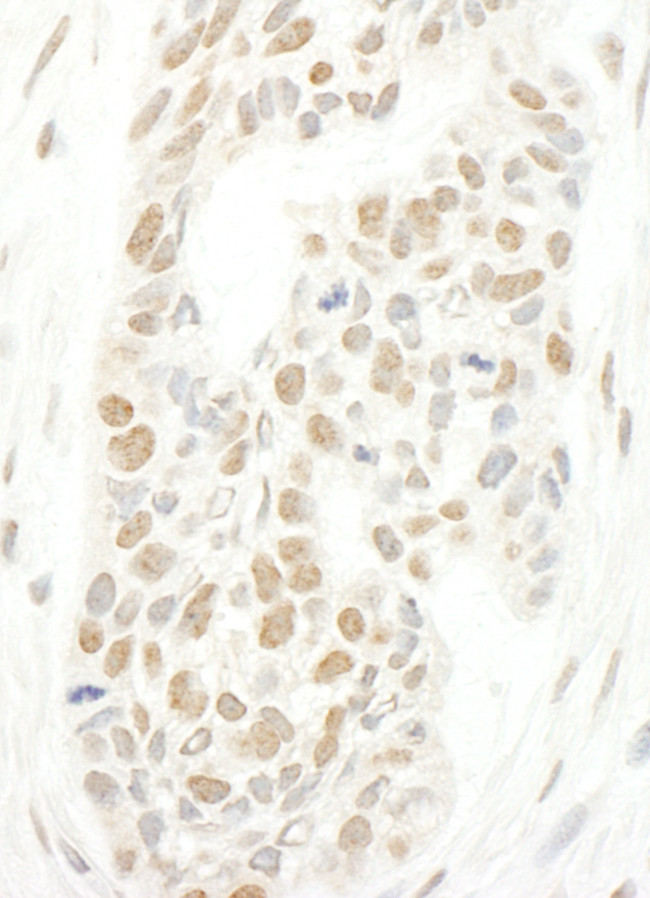 CAP-H2 Antibody in Immunohistochemistry (Paraffin) (IHC (P))