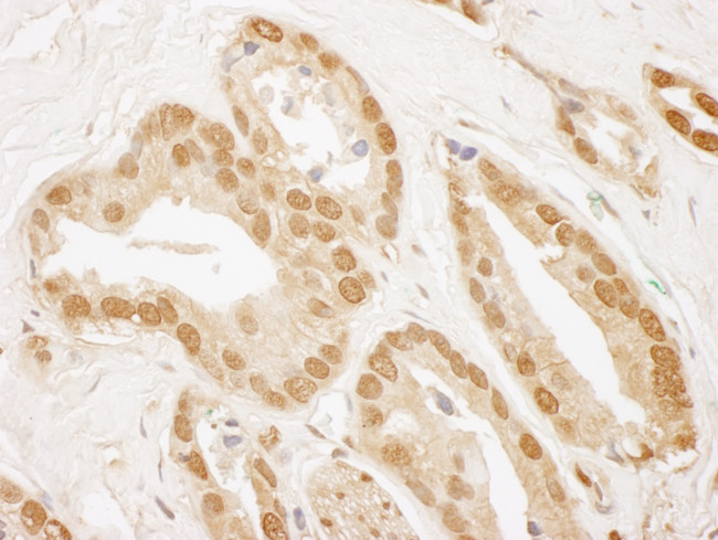 TIGAR Antibody in Immunohistochemistry (Paraffin) (IHC (P))