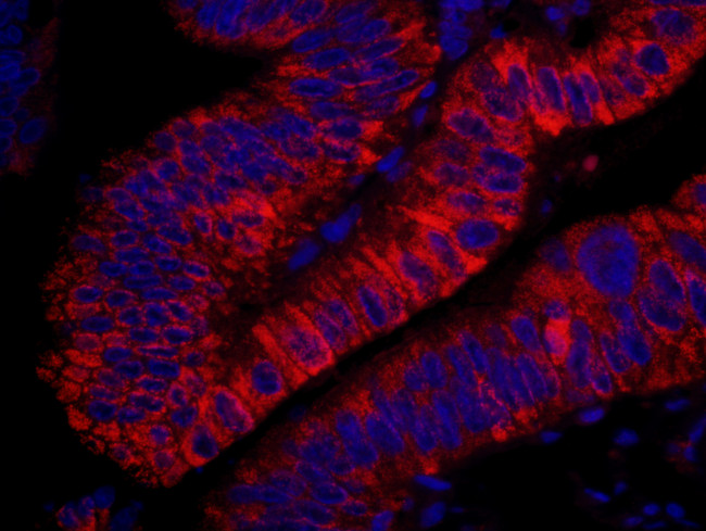 ARHGEF5 Antibody in Immunohistochemistry (Paraffin) (IHC (P))