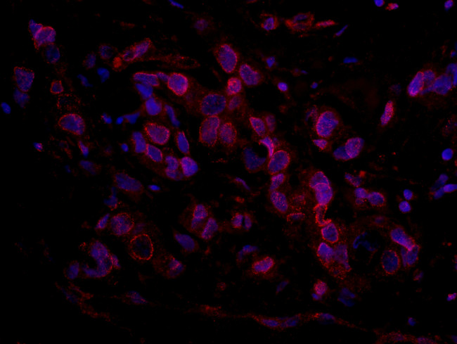 ARID4B Antibody in Immunohistochemistry (Paraffin) (IHC (P))