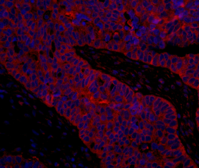 eIF3B/EIF3S9 Antibody in Immunohistochemistry (Paraffin) (IHC (P))