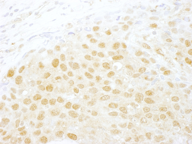 NCBP1/CBP80 Antibody in Immunohistochemistry (Paraffin) (IHC (P))