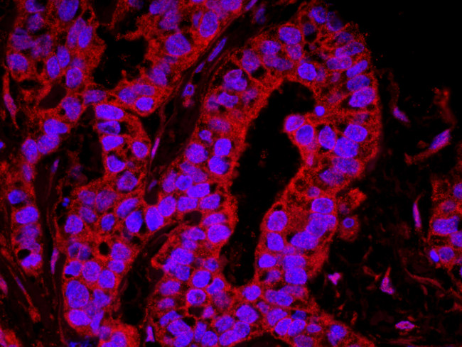 YAP1 Antibody in Immunohistochemistry (Paraffin) (IHC (P))