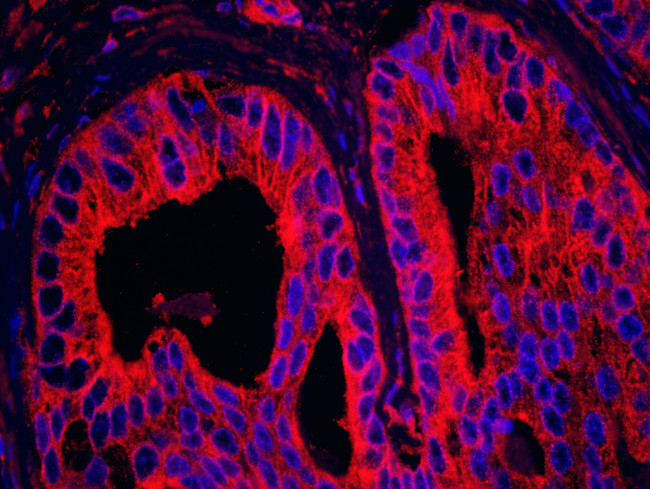 EB1 Antibody in Immunohistochemistry (Paraffin) (IHC (P))