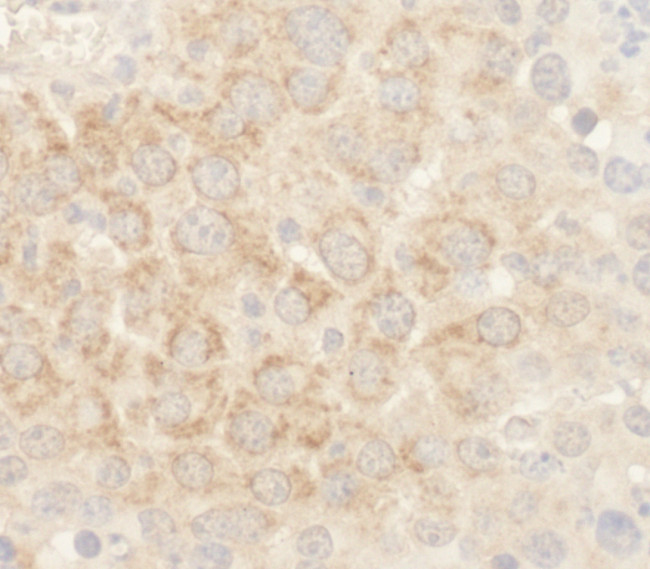 BAD Antibody in Immunohistochemistry (Paraffin) (IHC (P))